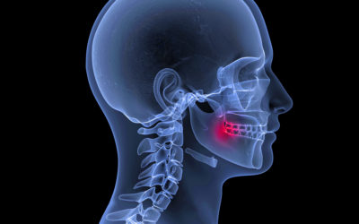 Do I Need a CBCT Report?