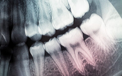 CBCT Dental Applications